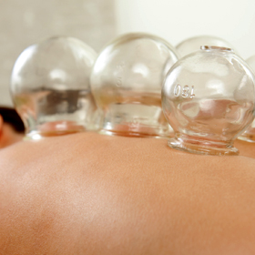 T-Cupping
