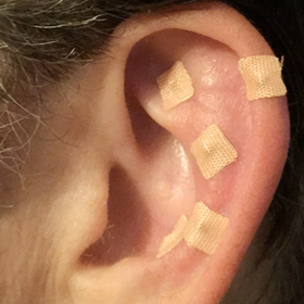 T-earseeds
